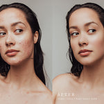 Newborn Photography Skin Retouching Photoshop Actions Best Lightroom Presets for Newborn Photography Newborn Maternity Portrait Photoshop Actions Skin Retouching Photoshop Actions by Jessica G. Photography