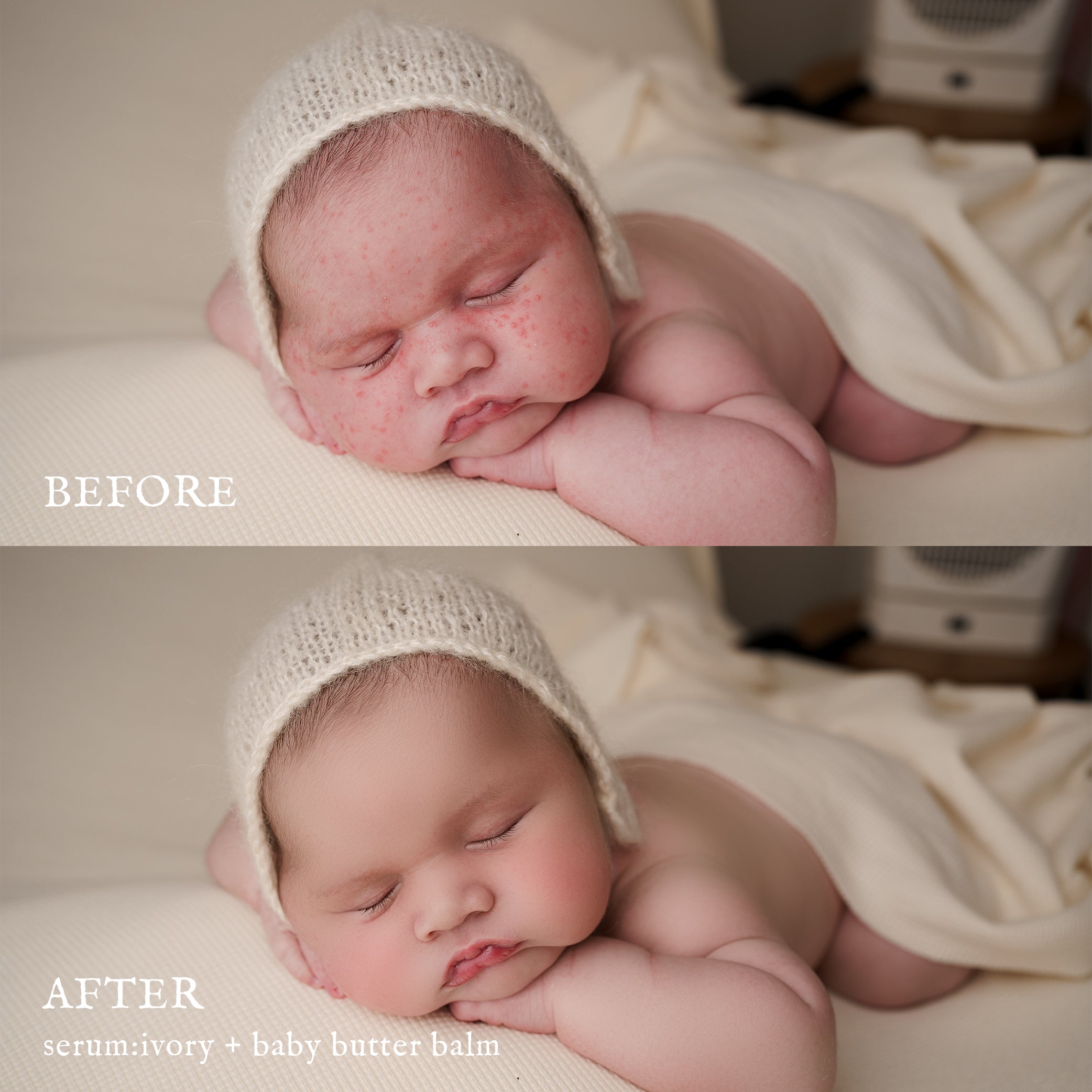Newborn Baby Skin Retouching